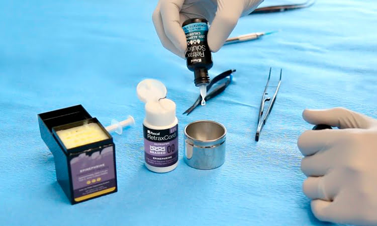 Dental Retrax® Solution delivering accurate micro-drops, smooth flow, and effective tissue management