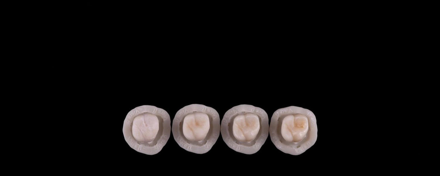 Retrax Solution — Excellent Retraction