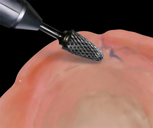 Using Hydent® Indication Stick to mark high spots on denture with soft, bendable tip for precise color transfer