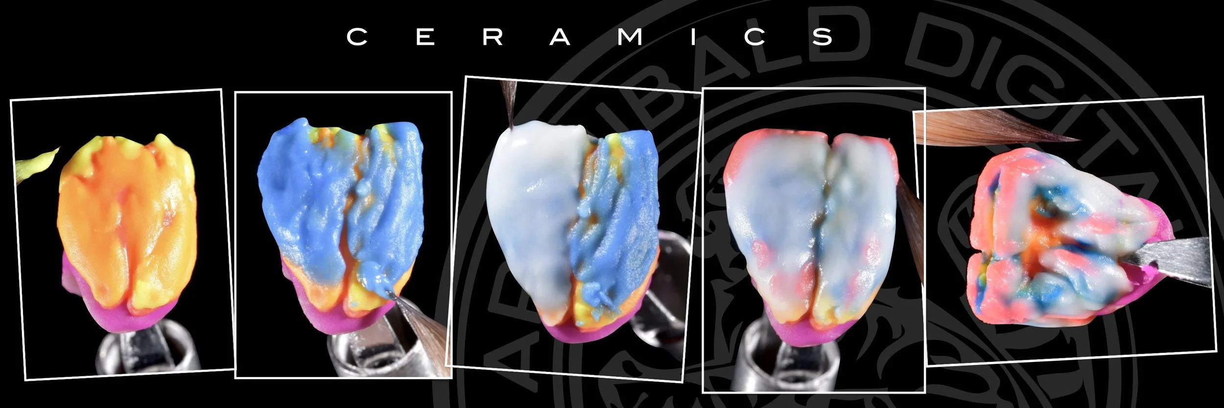 NanoByte™ by Archibald Digital – precision instrument for secure crown and veneer handling