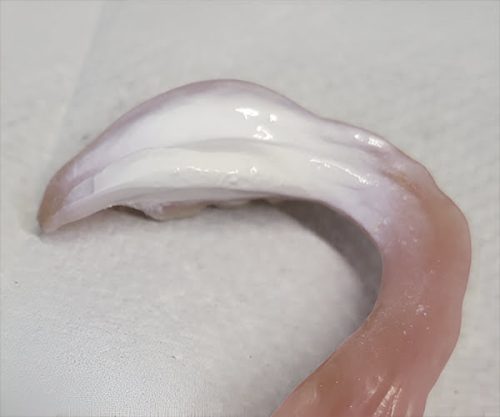 Step 2: HYDENT SPRAY — Apply a smooth coat of Hydent® Spray. Insert the appliance in the patient's mouth.